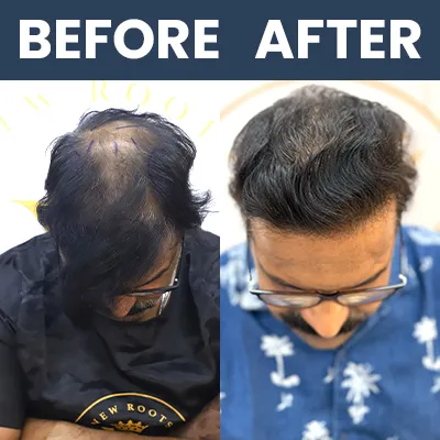 Hrishikesh Joshi - Result