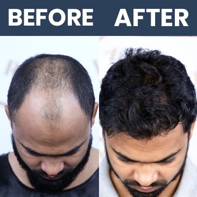 Hair Result Sep_01