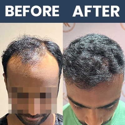 Hair Result Sep_04